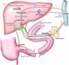 Photo for Hypercholesterolemia Drugs Market - Global Industry Insights, Trends, and Opportunity Analysis 2017 - 2025