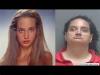 Photo for Hereditary Angioedema Market Size, Volume, Value and Growth Rate Research Report 2017