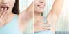 Photo for Laser Hair Removal – Common Questions Answered