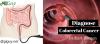 Photo for GiGuy Raleigh Colonoscopy Specialists Doctors Place of Safe Colorectal Cancer