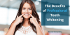 Photo for The Benefits of Professional Teeth Whitening
