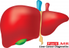 Photo for 7 Key Projections for Liver Cancer Diagnostics Market