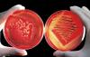 Photo for Major Insights of Global Blood Cell Analyzer Market Presented For the Forecast Period 2017-2022: Research Evaluates 6.2% CAGR