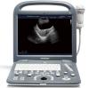 Photo for Sonoscape S2 Portable Color Doppler Ultrasound