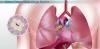 Photo for Tuberculosis Drugs Market is Expected to Witness a CAGR of 23.4% Throughout 2016 - 2024