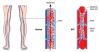 Photo for Global Antithrombin Market Set for Rapid Growth, to Reach USD 613.8 Million by 2022