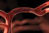 Photo for Neurovascular Devices/Interventional Neurology Market Trends and Global Outlook, 2016-2024