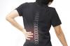 Photo for Get Rid of Cervical Spine Sprains with Los Angeles Spine Surgeons