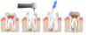 Photo for Dental Root Canal treatment | Root Canal Therapy