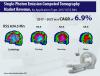Photo for Single-Photon Emission Computed Tomography Market will Register a CAGR of 6.9% through 2017-2027