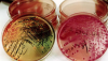 Photo for Enteric Disease Testing Market - Global Industry Insights and Opportunity Analysis, 2025