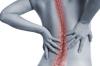 Photo for Find Relief from Chronic Back Pain with Spine Surgeons Beverly Hills