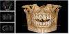 Photo for Cone Beam Computed Tomography Market Overview – Key Futuristic Trends and Opportunities 2025