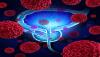 Photo for Benign Prostatic Hyperplasia Surgical Devices Market to Surpass US$ 812.8 Million by 2025