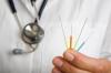 Photo for Frequently Asked Questions about Acupuncture