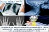 Photo for X-ray Market to Surpass US$ 14.4 Billion Threshold by 2025 Globally