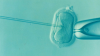 Photo for Infertility Treatment Market - Insights into the Competitive Scenario of the Market