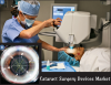 Photo for Cataract Surgery Devices Market - Global Opportunity Analysis, 2025