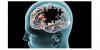 Photo for A Breakthrough Therapy Is Expected To Provide Immense Growth For The Anti-?-Alzheimer Therapies Market