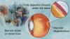Photo for Age–Related Macular Degeneration Market — Global Trends, 2017 - 2025