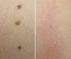 Photo for Cheerio To Shaving And Waxing