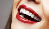 Photo for Get The Best Teeth Whitening clinic in London