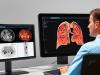 Photo for Computer Aided Detection Market - Outlooks and Opportunity Analysis 2025