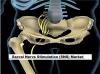 Photo for Sacral Nerve Stimulation Market to Earn a Valuation of US$3.3 billion by the end of 2025