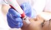 Photo for Global Medical Aesthetics Market Research and Analysis 2024