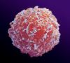 Photo for Important Players Present In The Hematopoietic Stem Cell Transplantation Market