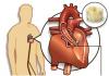 Photo for Transcatheter Aortic Valve Implantation (TAVI) Market – Global Trends, 2017–2025