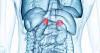 Photo for Cushings Syndrome Market – Global Opportunity Analysis,  2017 - 2025