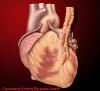 Photo for Vascular Graft Market Competitive Analysis & Forecast by 2016 – 2025