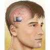 Photo for Neurostimulation Devices Market – Global Opportunity Analysis, 2016–2025