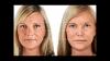 Photo for Skin Products With Hyaluronic Acid