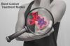 Photo for Bone Cancer Treatment Market - Global Industry Insights, 2016–2024