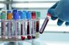 Photo for Clinical Laboratory Services Market 2016 - 2024: Global Major Key players Siemens AG, Sonic Healthcare Limited, Carlyle Group and others
