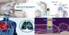 Photo for Radiotherapy Market to Surpass Beyond US$ 9.5 Billion by 2025 with CAGR of 6.8%