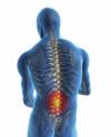 Photo for Treat Back Pain by Eliminating Source of the Pain