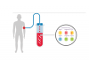 Photo for Liquid Biopsy Market –  Trends and Forecast to 2025