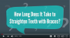 Photo for How Long Does It Take to Straighten Teeth with Braces?