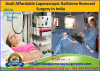 Photo for Laparoscopic Gallbladder Removal Surgery costs in India?