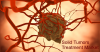 Photo for Global Solid Tumors Treatment Market - Opportunity Analysis, 2017–2025