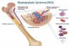 Photo for Myelodysplastic Syndrome Treatment Market to Worth $ 5.7 Billion by 2025 | CAGR: 12.7%