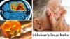 Photo for Alzheimer’s Drugs Market to Surge beyond US$ 15 Billion by 2025