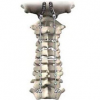Photo for Global Spine Surgery Products Market Forecast to 2023