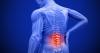 Photo for Back Pain Therapy Market - Global Industry Insights, Size, Trends and Analysis, Forecast, 2017 - 2025