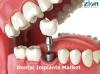 Photo for Dental Implants Market: Global Industry Analysis, Size, Share, Growth, Trends, and Forecasts 2016–2024