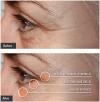 Photo for EyeSerum Magic - Enhance collagen and elastin production