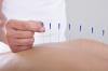 Photo for Rachael Scully Acupuncture